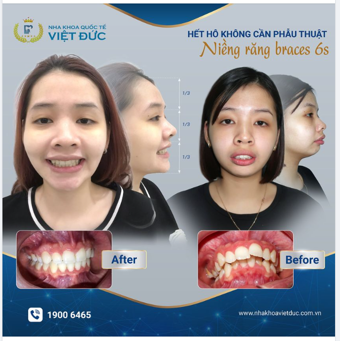 F5 TRỞ THÀNH PHIÊN BẢN ĐẸP NHẤT CỦA CHÍNH MÌNH