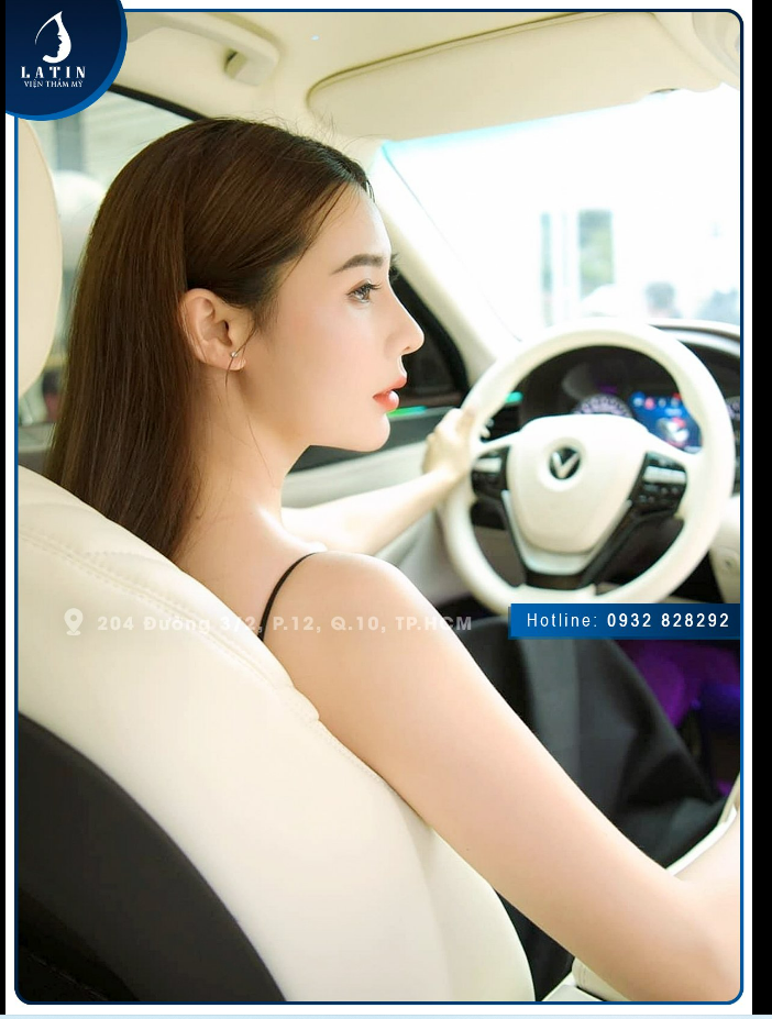 FEEDBACK Combo mũi cấu trúc, cằm sụn Mỹ nhà Latin sau 3 năm