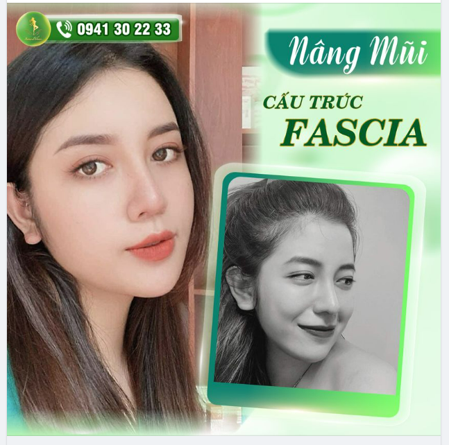 FEEDBACK ĐẦU TUẦN SANG XỊN CỦA SAIGON VENUS