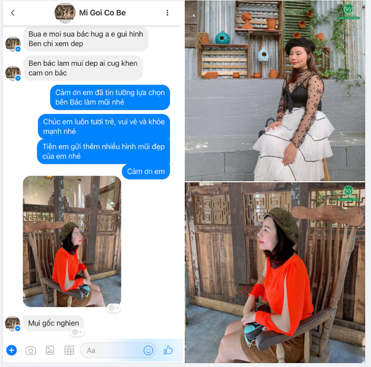 FEEDBACK NÂNG MŨI SAU 6 THÁNG CỦA KH XINH ĐẸP