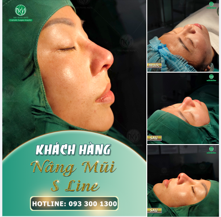 FORM MŨI S LINE SỬA LẠI CHO KHÁCH HÀNG