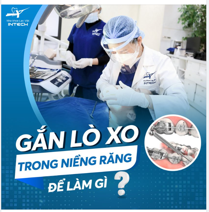 GẮN LÒ XO TRONG NIỀNG RĂNG ĐỂ LÀM GÌ?
