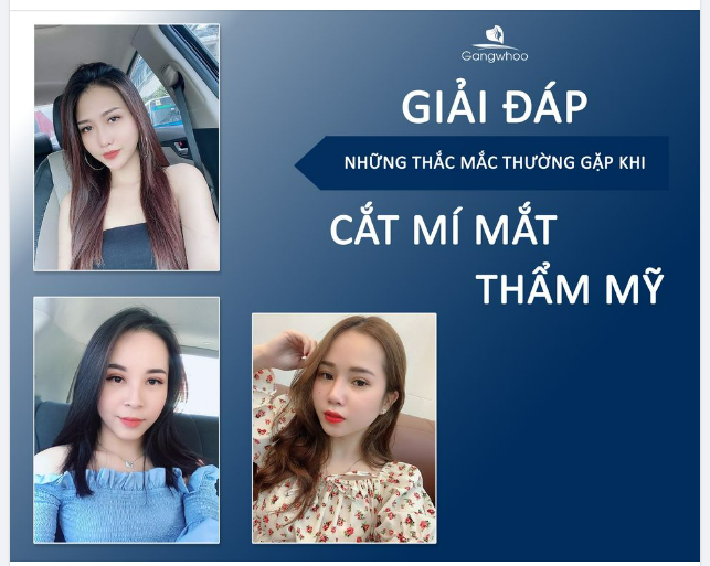 GIẢI ĐÁP NHỮNG THẮC MẮC THƯỜNG GẶP KHI CẮT MÍ MẮT