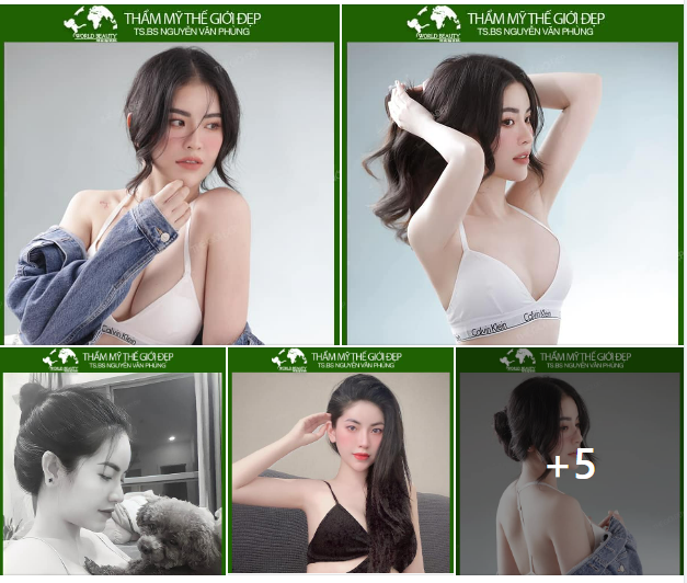Giải pháp làm đẹp bằng Combo tạo hình MŨI + NGỰC luôn được nhiều tín đồ làm đẹp lựa chọn bởi những ưu điểm không thể bỏ qua
