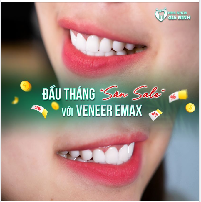 GIẢM 50 % TRONG THÁNG 8 KHI DÁN 16 SỨ VENEER EMAX