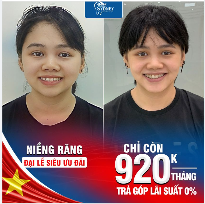 Giảm ngay ??% cho 30 khách hàng đặt lịch niềng răng mắc cài pha lê trong suốt.