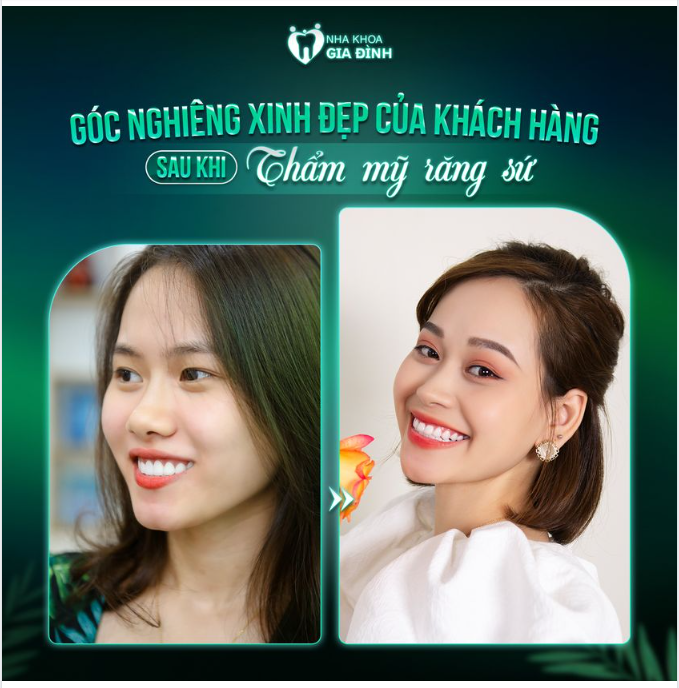 GÓC NGHIÊNG THẦN THÁNH MÀ AI CŨNG MUỐN CÓ