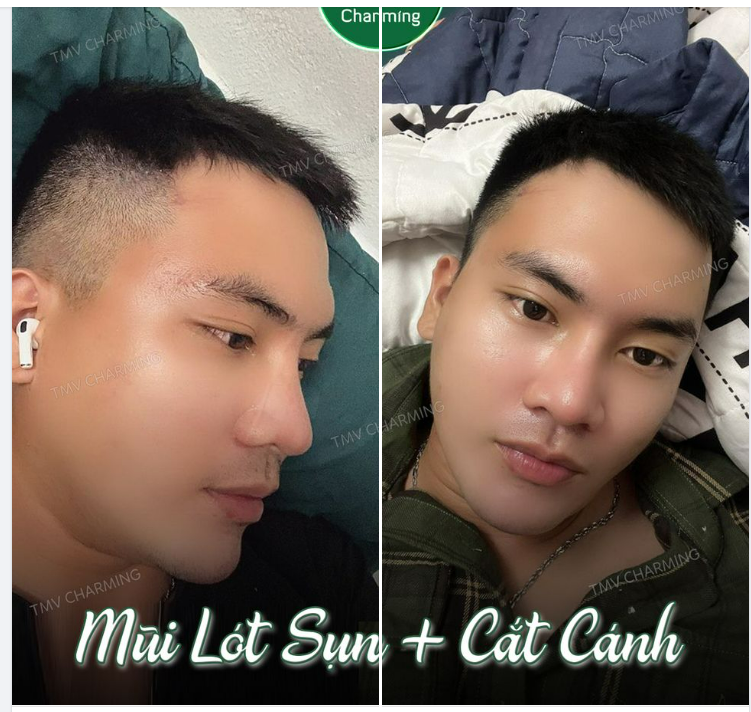 Hàng hiếm, hàng hiếm đâyyyyy.