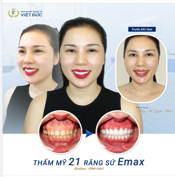 ​​​​​​​Hạnh phúc chính là nhìn khách hàng cười rạng rỡ mỗi ngày!