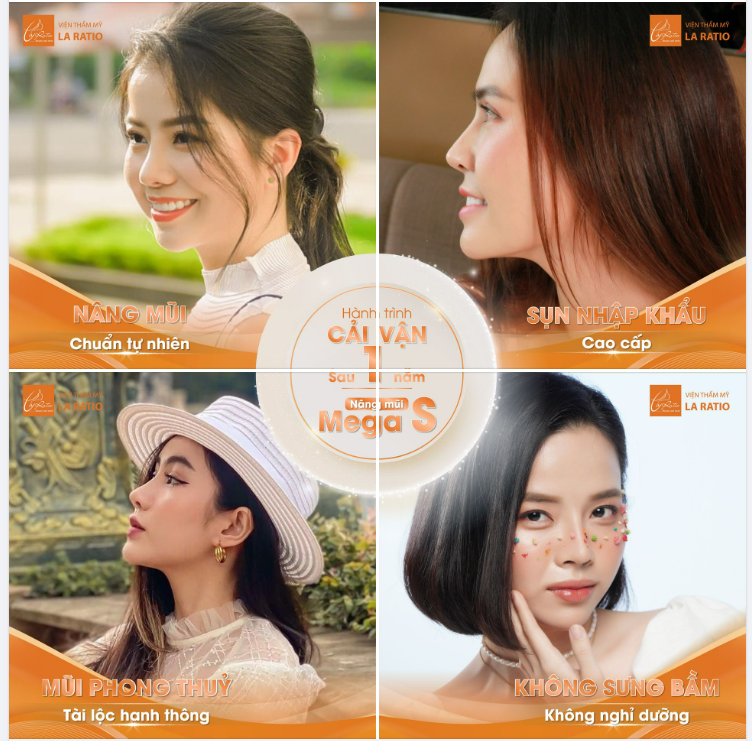 HÀNH TRÌNH CẢI VẬN SAU 1 NĂM NÂNG MŨI MEGAS