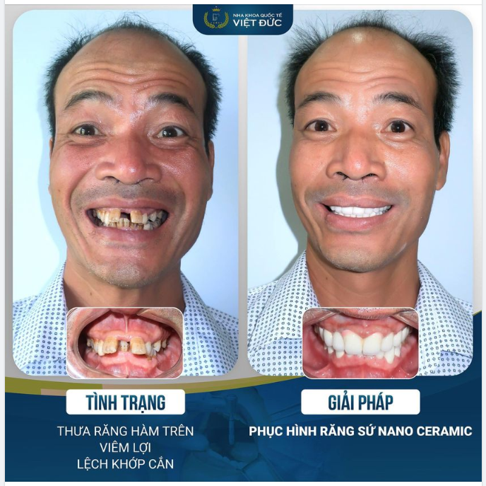 HÃY LUÔN CƯỜI THẬT TƯƠI VÌ ĐIỀU ĐÓ THẬT TUYỆT VỜI