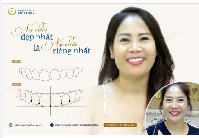 HÃY TRỞ THÀNH PHIÊN BẢN ĐẸP NHẤT CỦA CHÍNH MÌNH