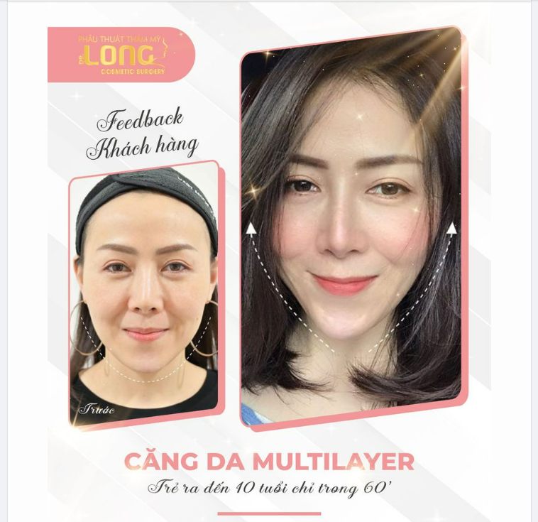 HỒI XUÂN NGOẠN MỤC - KHÔNG DÙNG THUỐC - KHÔNG SỬ DỤNG MỸ PHẨM