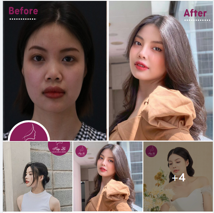 HOTGIRL HƯƠNG NGUYỄN HÀNH TRÌNH ĐẠT ĐẾN VẺ ĐẸP HOÀN HẢO