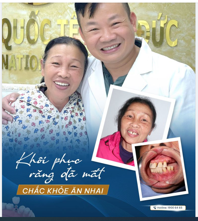 IMPLANT - GIẢI PHÁP HOÀN HẢO KHÔI PHỤC RĂNG ĐÃ MẤT