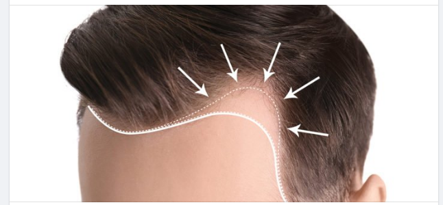 KỂ NGHE CÂU CHUYỆN CỦA CASE THỨ 2