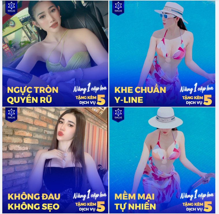 KẾT QUẢ NÂNG NGỰC SAU 3 THÁNG