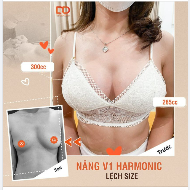 KHẮC PHỤC TÌNH TRẠNG NGỰC LỆCH KHÔNG CÂN ĐỐI
