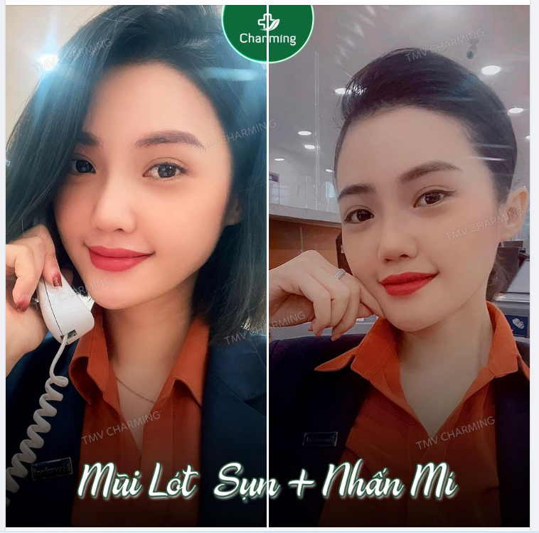 Khách bảo là từ hồi nâng mũi cắt mí rồi, cuộc đời lên hương hẳn.