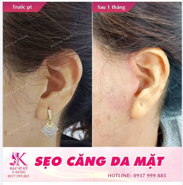 Khi bạn già đi, khuôn mặt của bạn bị thay đổi.