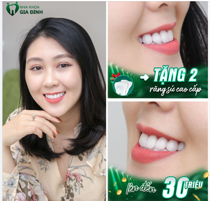 KHÔNG LỢI NHUẬN] LÀM RĂNG TẶNG RĂNG. CÒN GÌ TUYỆT VỜI HƠN???