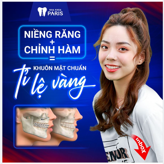 KHUÔN MẶT CHUẨN TỶ LỆ VÀNG NHỜ NIỀNG RĂNG + PHẪU THUẬT HÀM NHƯ THẾ NÀO?
