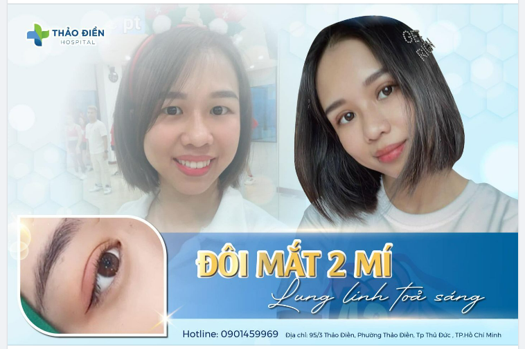 KIẾN TẠO ĐÔI MẮT 2 MÍ - LUNG LINH TOẢ SÁNG