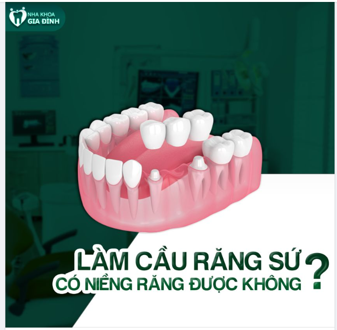 LÀM CẦU RĂNG SỨ CÓ NIỀNG RĂNG ĐƯỢC KHÔNG?