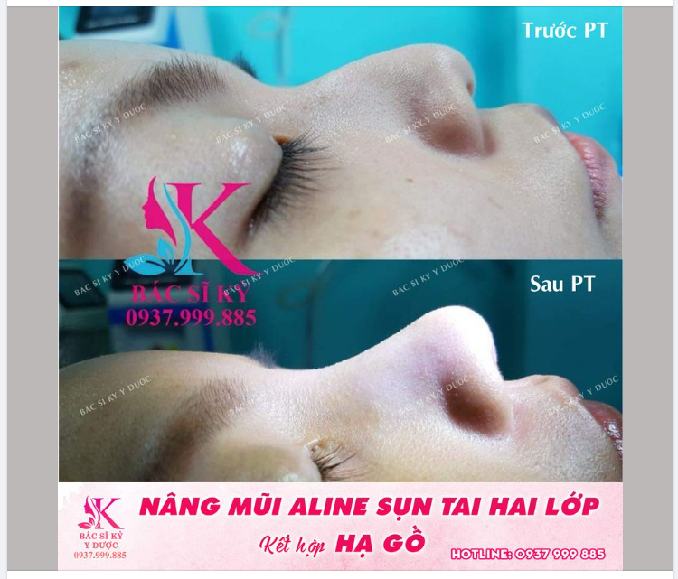 Làm đẹp là một hành trình gian nan và cũng lắm công phu.