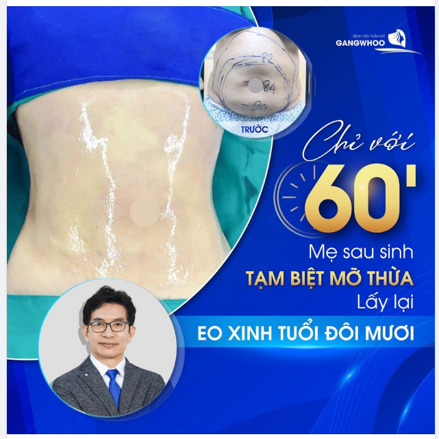 LIPO ULTRASOUND – CÔNG NGHỆ GIẢM MỠ “TỐI TÂN”