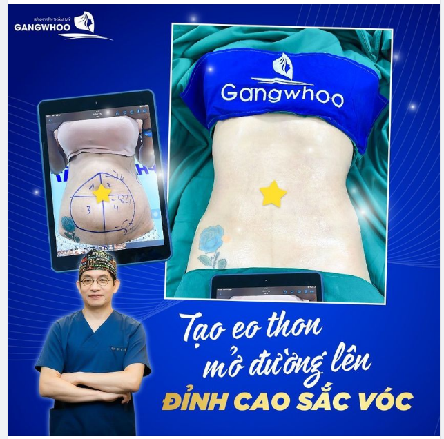 LIPO ULTRASOUND - KHÔNG HẾT MỠ LÀ HOÀN TIỀN