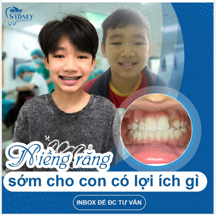 LỢI ÍCH KHI NIỀNG RĂNG SỚM CHO TRẺ