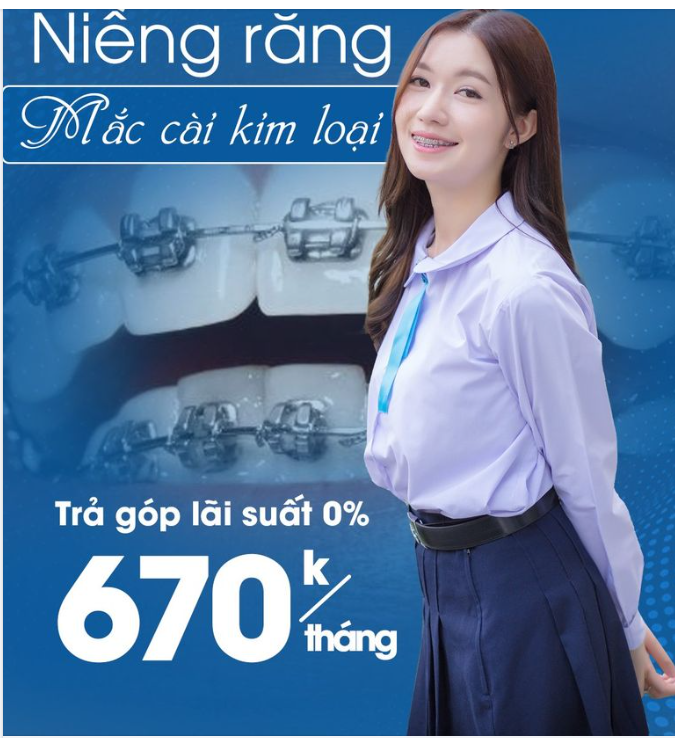 LỢI ÍCH NIỀNG RĂNG TRẢ GÓP TẠI NHA KHOA HÀ NỘI SYDNEY