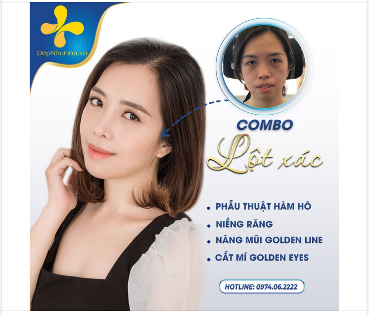 LỘT XÁC NGOẠN MỤC VỚI COMBO 4 DỊCH VỤ