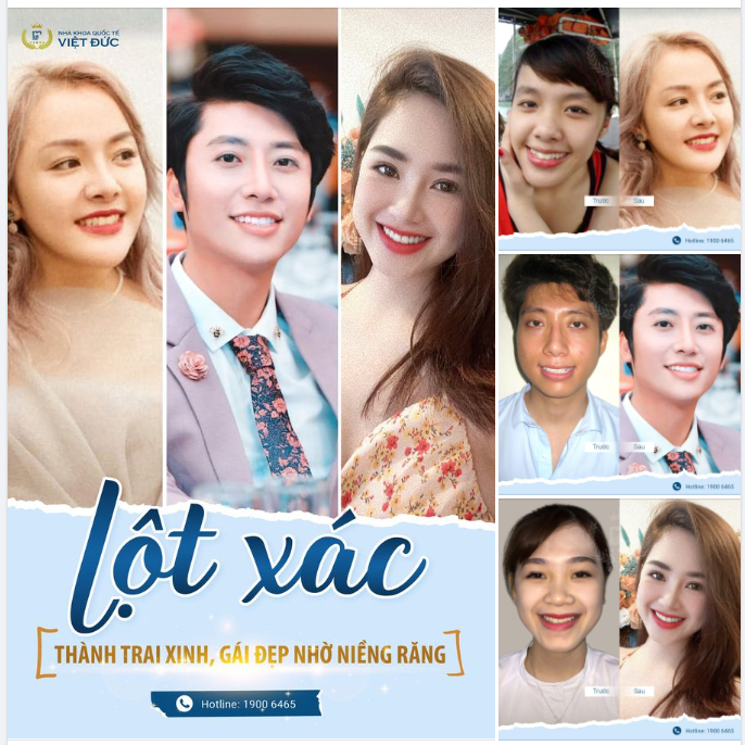 "LỘT XÁC" THÀNH PHIÊN BẢN "MỘT NGƯỜI KHÁC" CHỈ NHỜ NIỀNG RĂNG