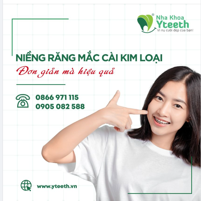 MẤT GÌ KHI NIỀNG RĂNG.
