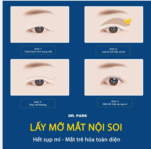 MỠ MÍ MẮT – DẤU HIỆU LÃO HÓA KHÔNG CÒN LÀ BÀI TOÁN KHÓ