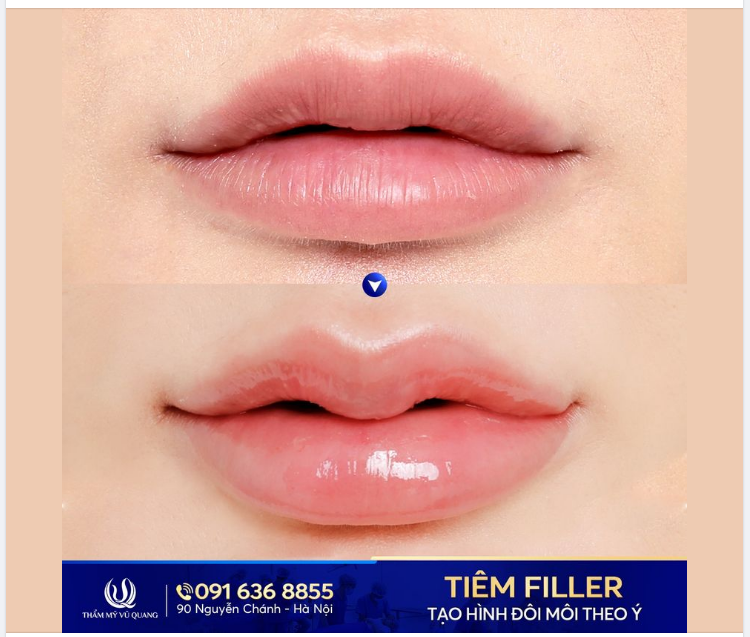 Môi căng mọng sức sống. Dáng môi yêu kiều, gợi cảm. Viền môi rõ nét, khóe môi cười duyên dáng