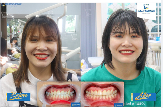 Mỗi cây mỗi hoa, mỗi người một nụ cười đẹp xinh