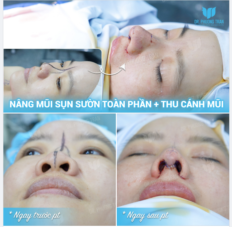 Mới có một bạn khách tâm sự “Em kỹ tính lắm, đi tư vấn nhiều, còn vào xem sản phẩm thật của họ. Nhưng mà nhiều khi lên hình đẹp, ở ngoài giả trân bác sĩ ơi!”