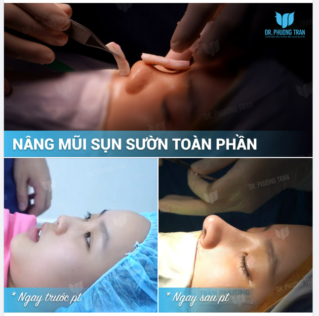 Một chấm là say đắm. Hai chấm là đắm say…