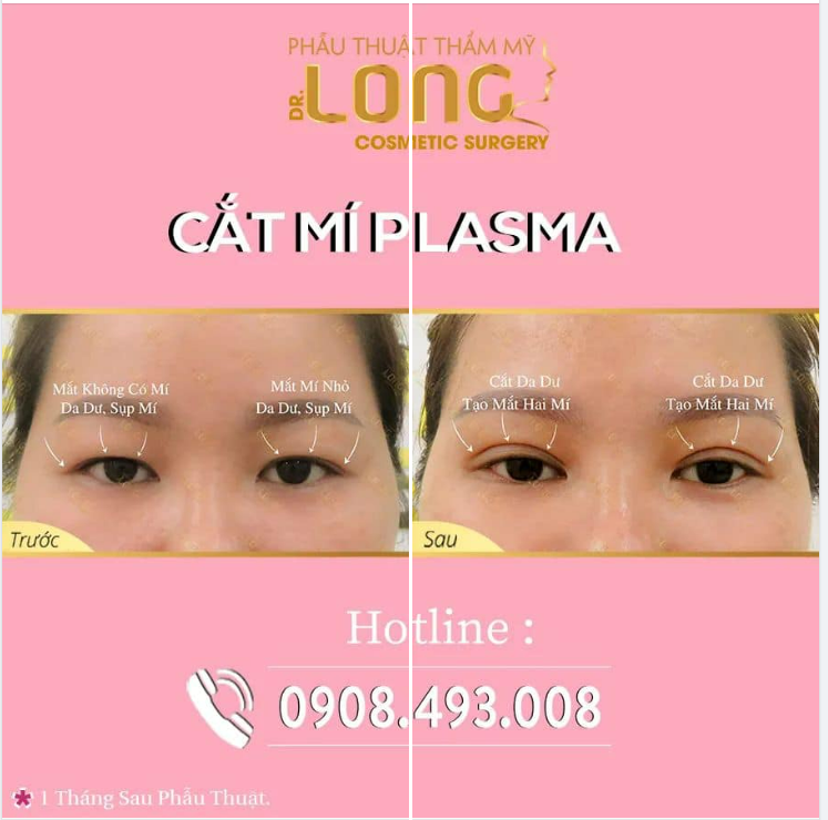 MỘT ĐÔI MẮT ĐẸP TẠO NÊN ĐIỀU GÌ