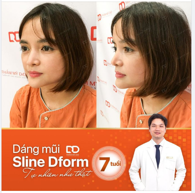 MŨI 7 TUỔI, ĐẸP TỰ NHIÊN NHƯ THẬT