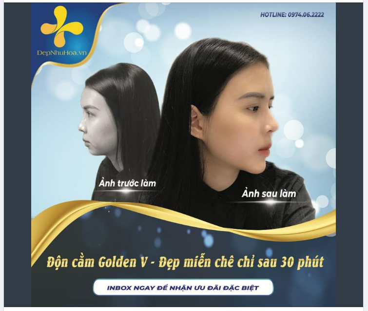 MŨI CAO, MẮT ĐẸP VẬY MÀ THỨ EM THIẾU NHẤT VẪN LÀ CẰM XINH.