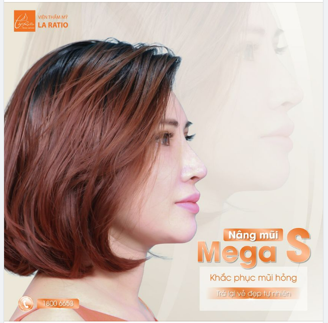 MŨI MEGA S – CỨU TINH CỦA NHỮNG CHIẾC MŨI HỎNG