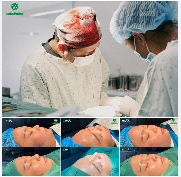 MŨI MEGADERM CHỈ 12,5 TRIỆU ĐỒNG