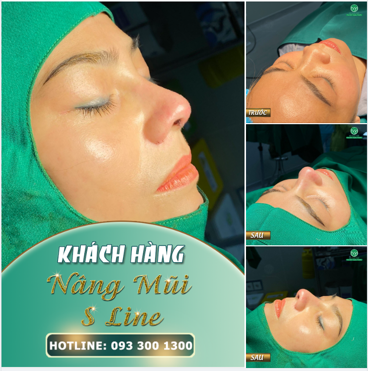 MŨI S LINE SÁNG ĐẦU TUẦN THỨ 2