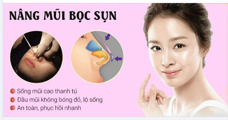 MŨI THẤP, DA ĐẦU MŨI MỎNG…LIỆU NÂNG MŨI CÓ GÂY LỘ SÓNG