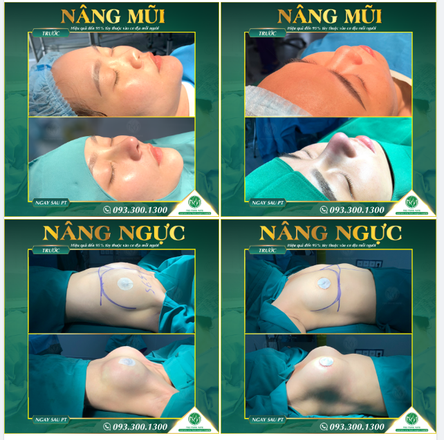 MUỐN ĐẸP LÀ KHÔNG ĐỢI!!!