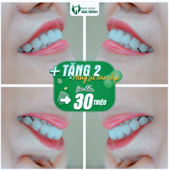 MUỐN LÀM RĂNG ĐẸP HÃY CHỌN BÁC SĨ CHỚ CHỌN GIÁ RẺ!